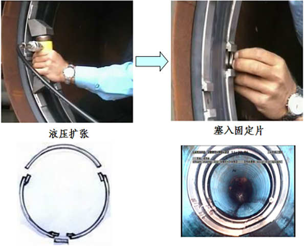 双胀圈固化修复(图3)